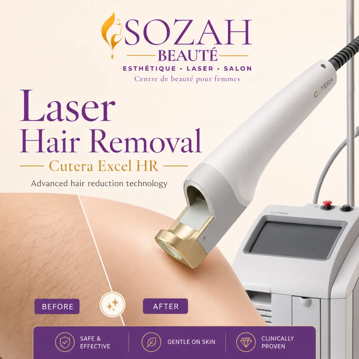 Épilation au laser